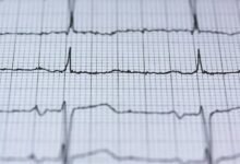 titan pulse performance node